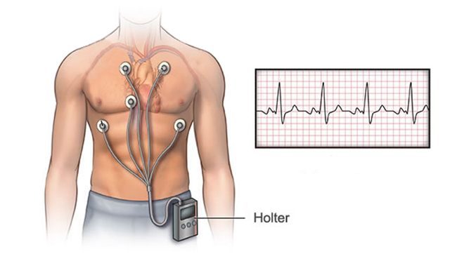 holter