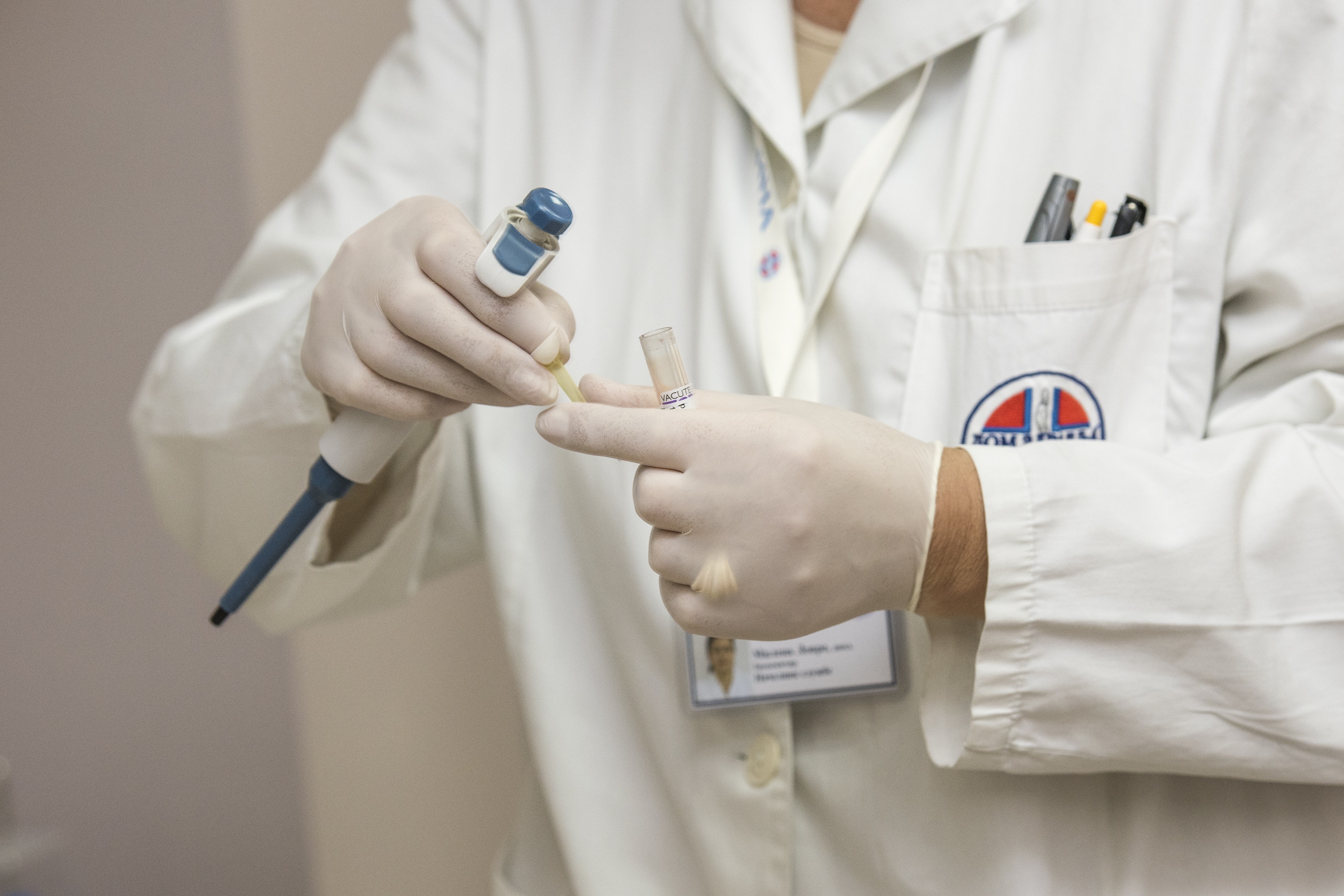 simptomi uvecane prostate